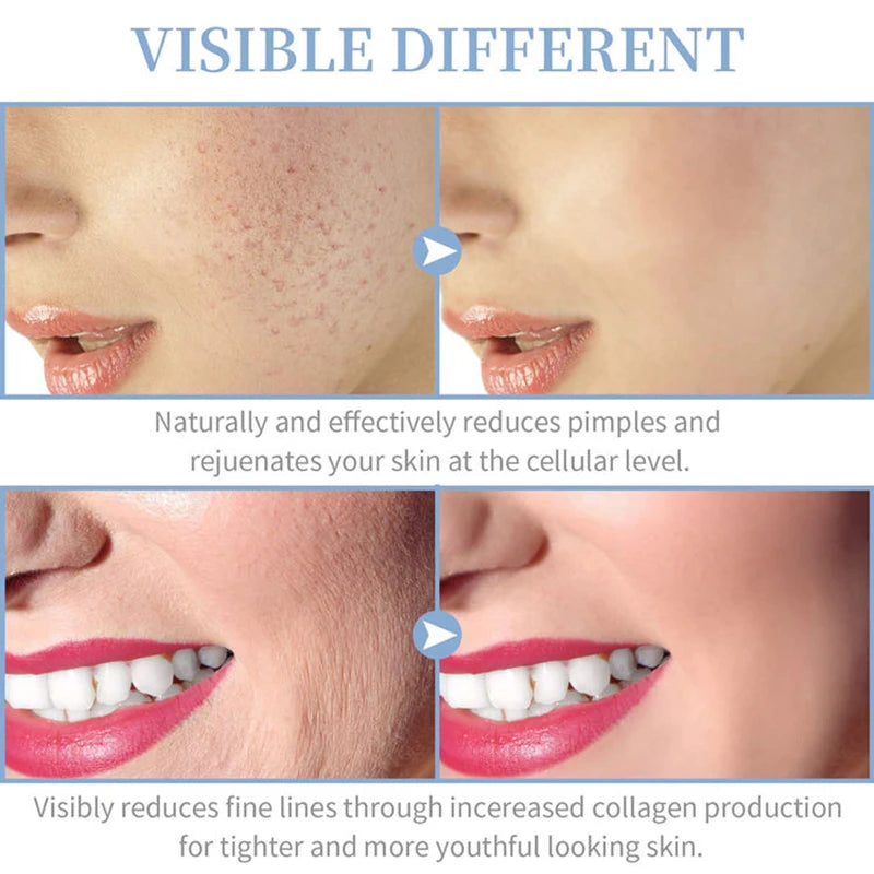 Revive  Radiate High-Frequency Wand™