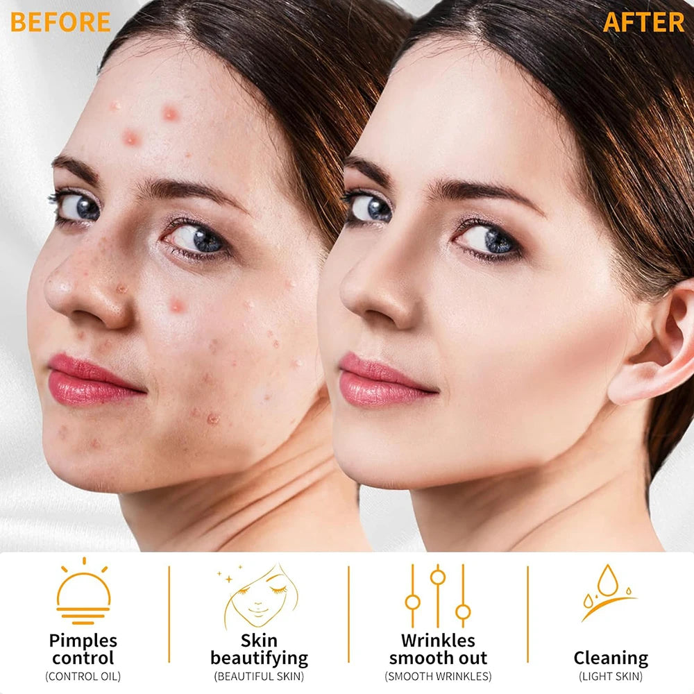Revive  Radiate High-Frequency Wand™