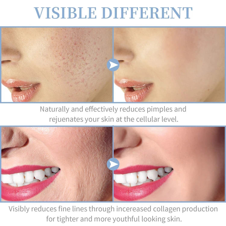 Revive  Radiate High-Frequency Wand™