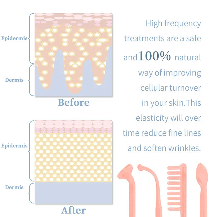 Revive  Radiate High-Frequency Wand™